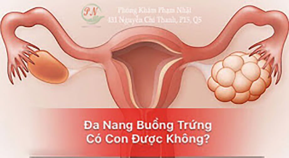 Buong-Trung-Da-Nang-Co-Con-Duoc-Khong.jpg