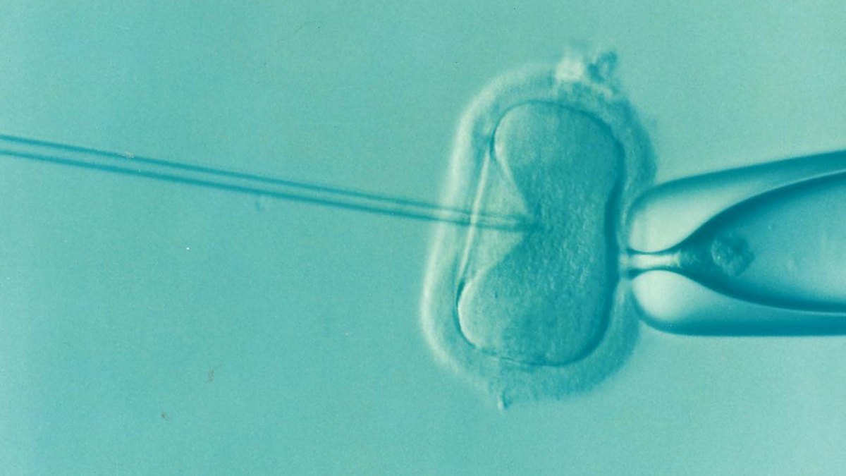 Thao tác vi thao tác trên noãn trong phòng lab IVF