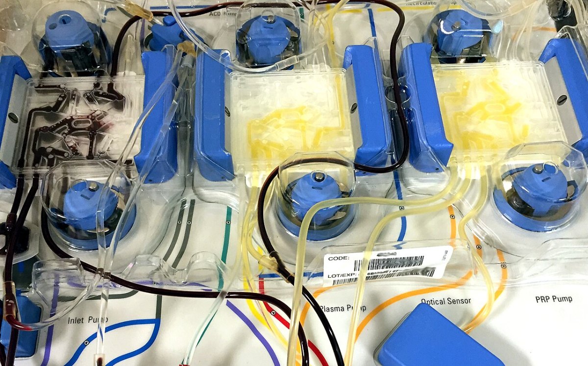 Máy lọc tách máu (apheresis) – nguyên lý tương tự phương pháp điều trị mới